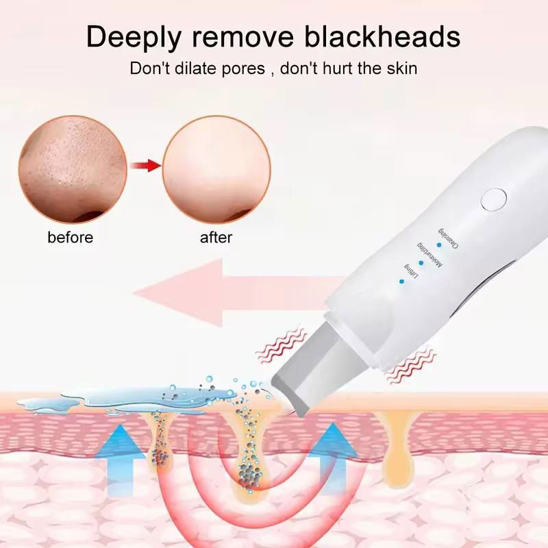 جهاز تنظيف البشرة بالموجات فوق الصوتية – Shovel Skin Machine_thumbnail_1